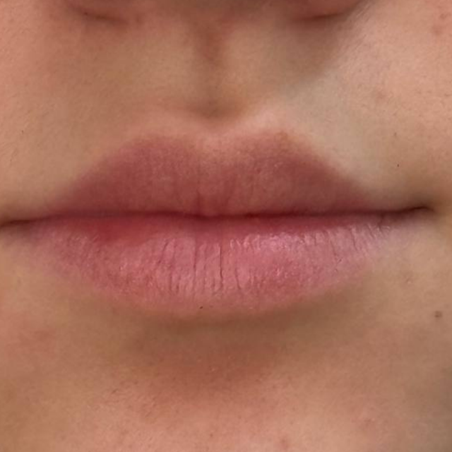 Before image