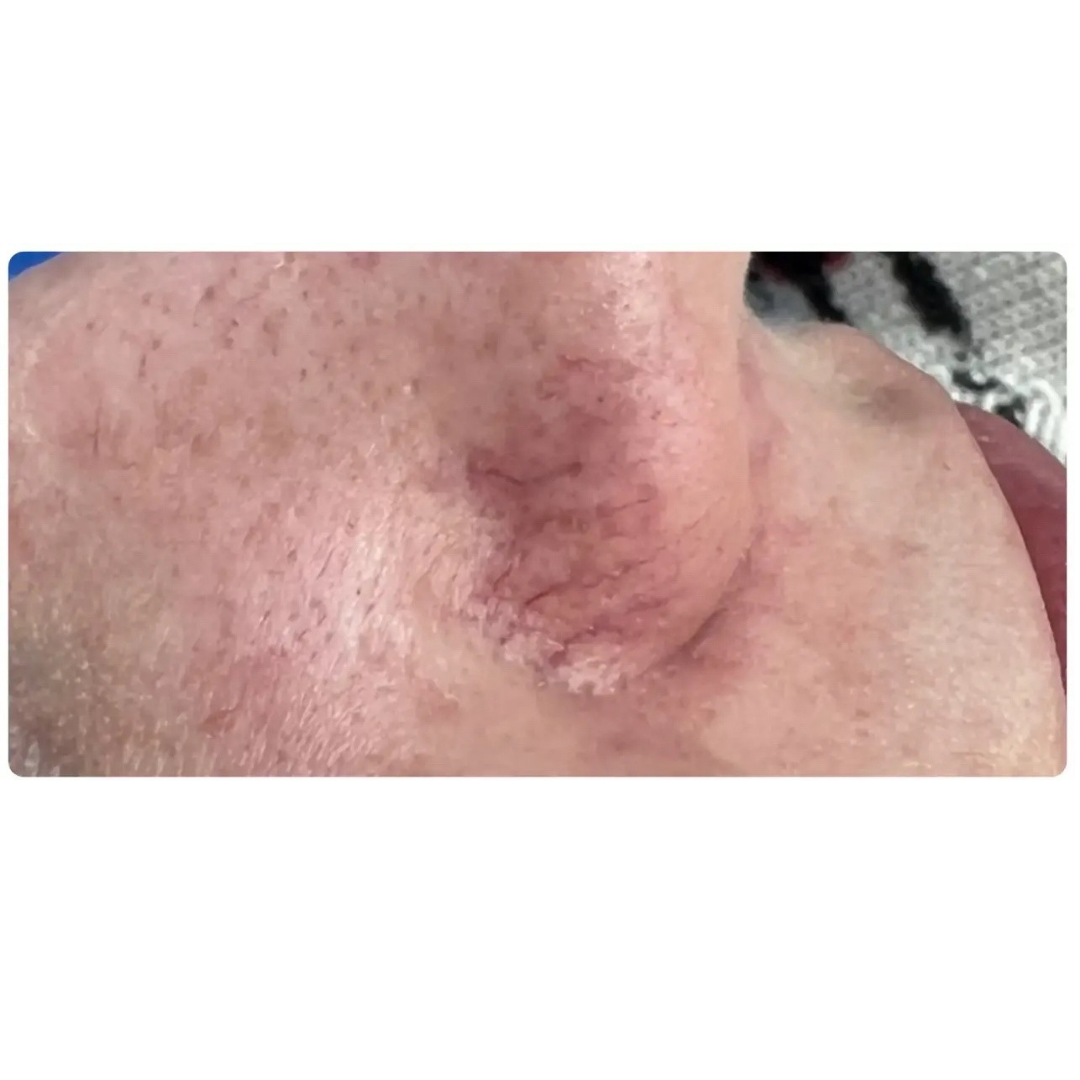 Before image