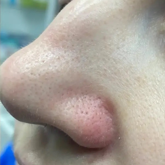After image