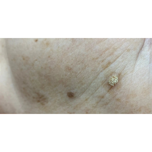 Before image