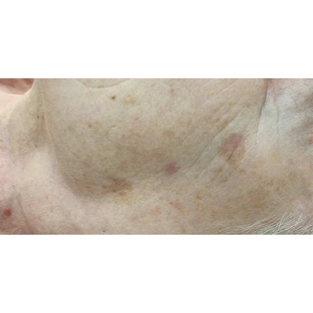 After image