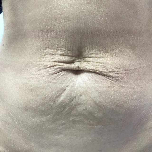 Before image