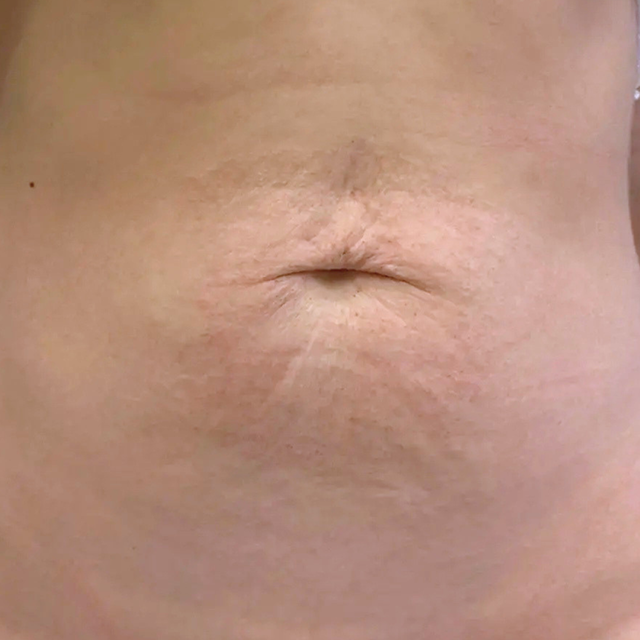 After image