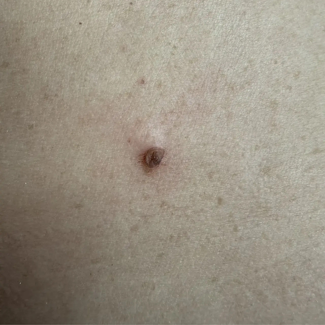Before image