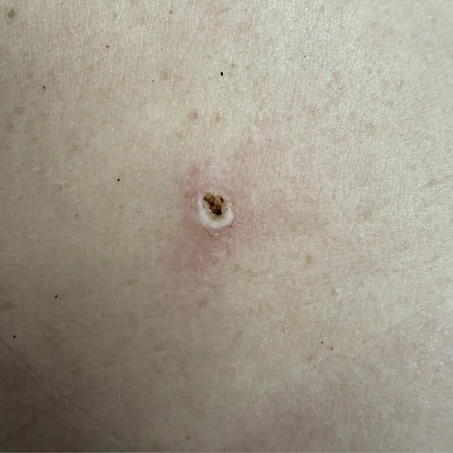 After image